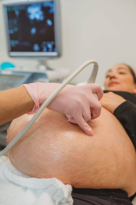Close-up of warmed gel and the transducer during a scan at Sweet 3D Baby.