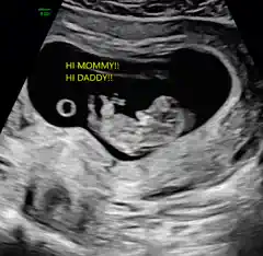 A baby moving on a 2D scan, with a message typed on screen.