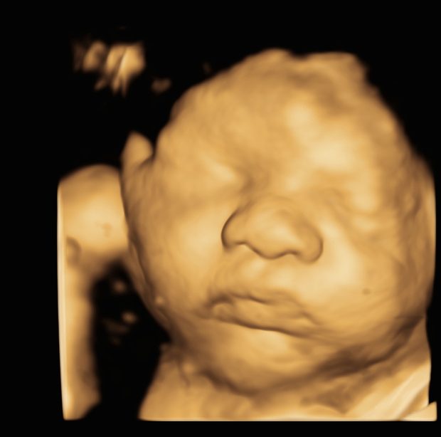 A baby's face in 3D, hand tucked up beside the cheek.