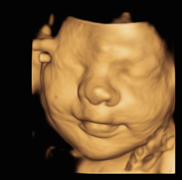 A smiling baby face in 4D.