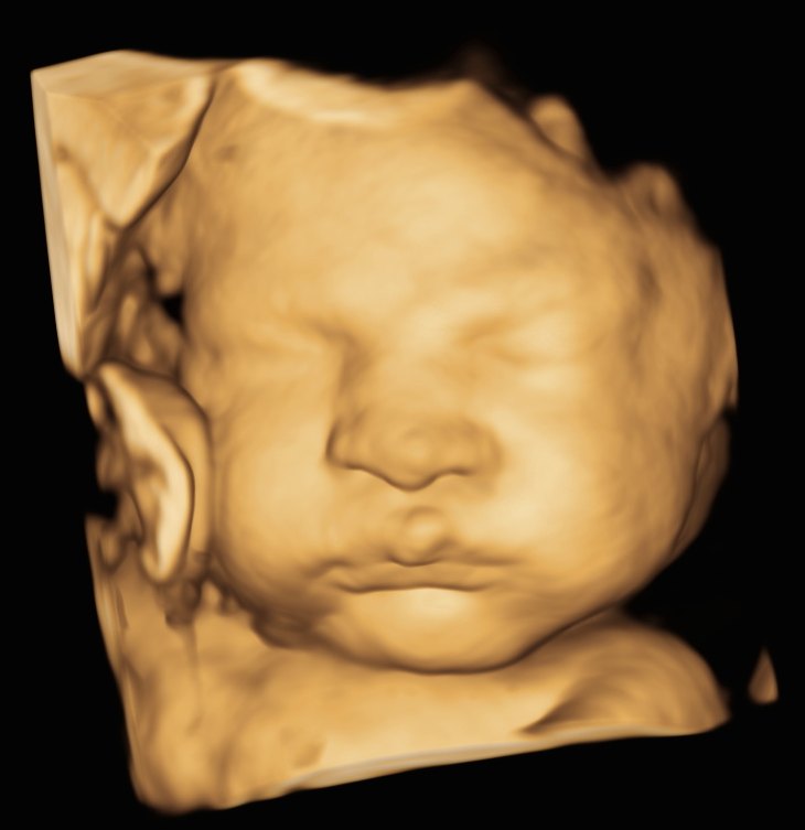 A baby at 34 weeks in 3D with full cheeks.