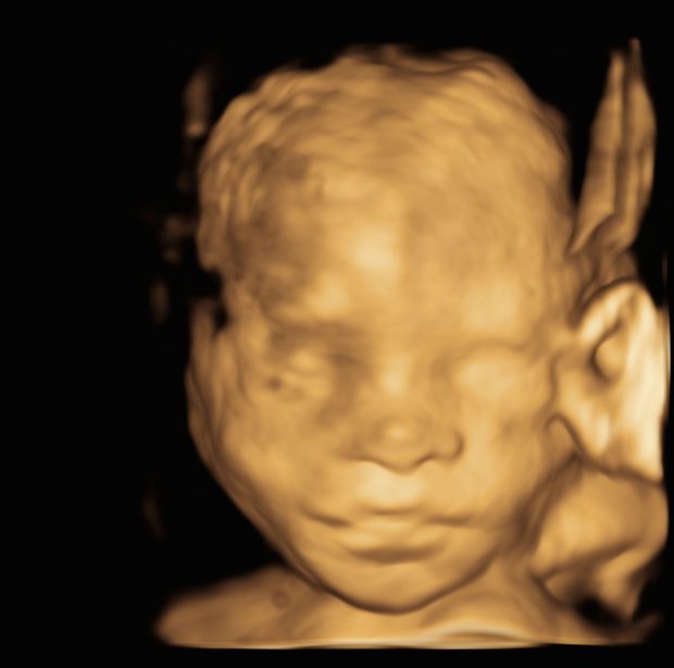 A baby in 3D with a clear ear and full cheeks.