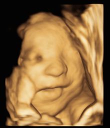 A baby at 32 weeks in 3D with full cheeks and a hand near the face.