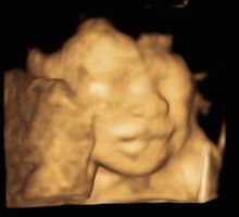 A baby at 24 weeks in 3D.