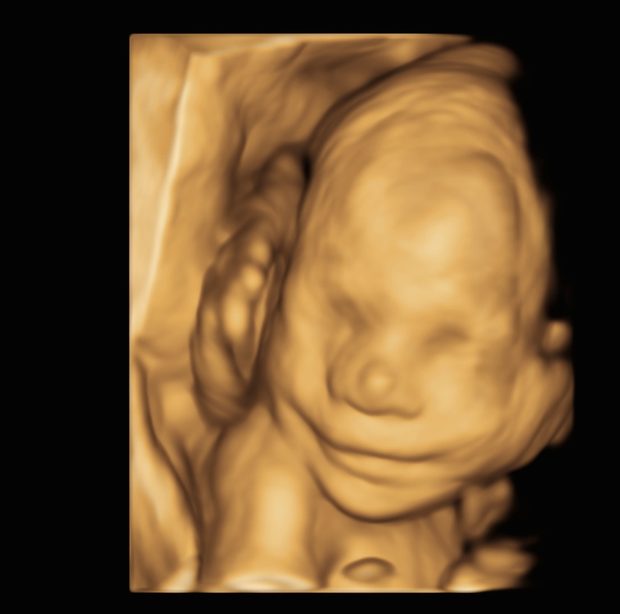 A smiling baby in 4D, hands near the face.